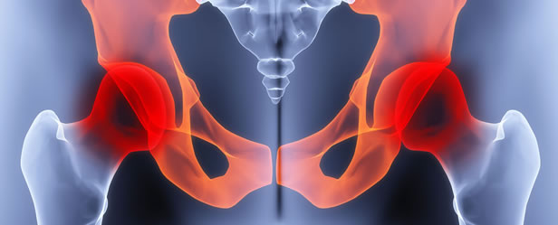 Chronic Pelvic Pain Syndrome – CPPS